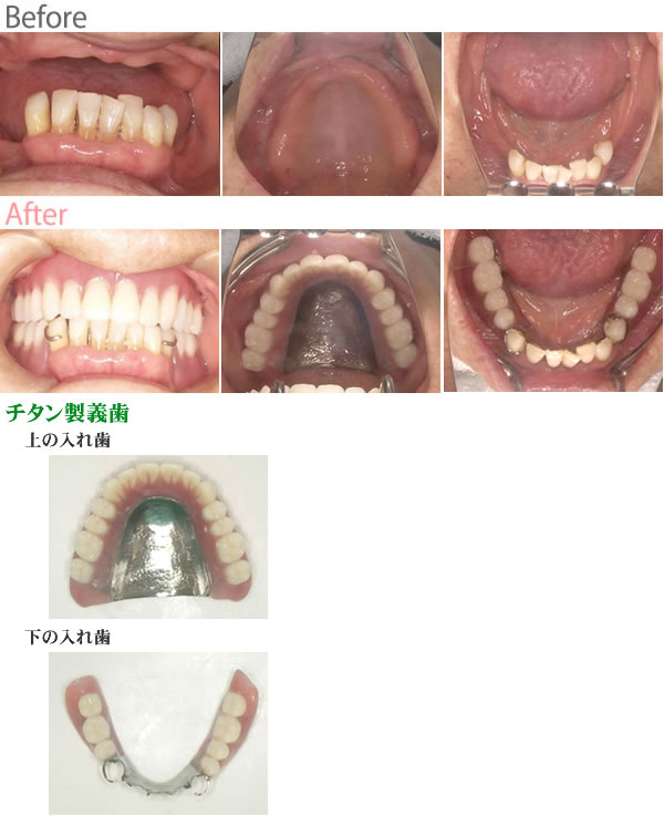 患者様の声 函館市の歯科 なしき歯科医院