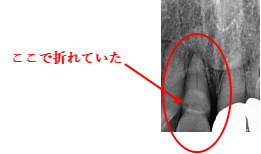 륻ߥå