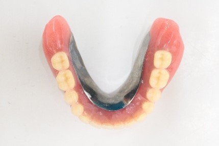 マグネット義歯