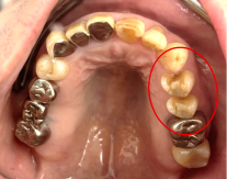 �����륻��ߥå���