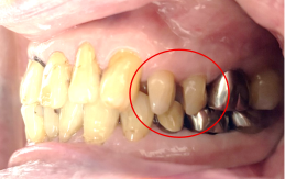 �����륻��ߥå���