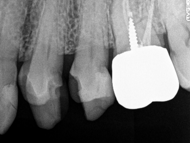 �����륻��ߥå���