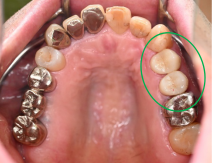 �����륻��ߥå���