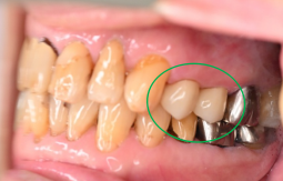 �����륻��ߥå���