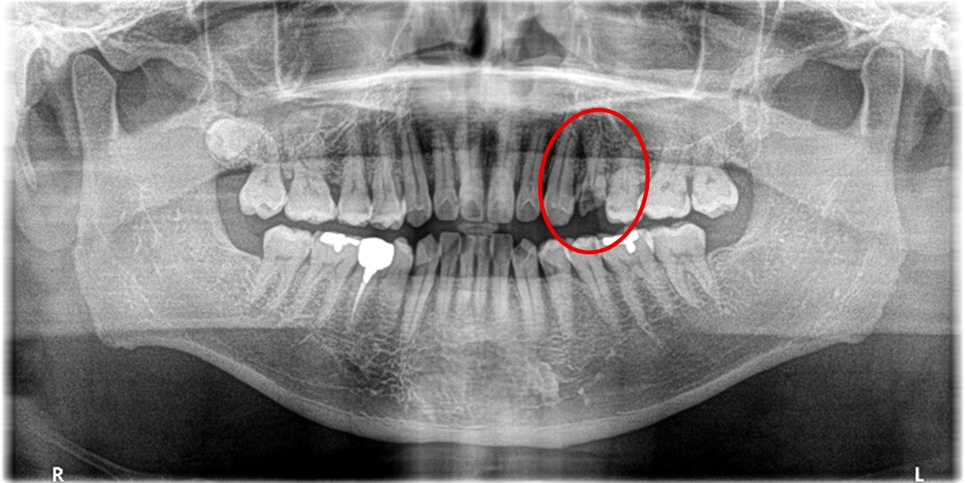 �����륻��ߥå���