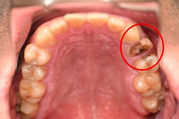 �����륻��ߥå���