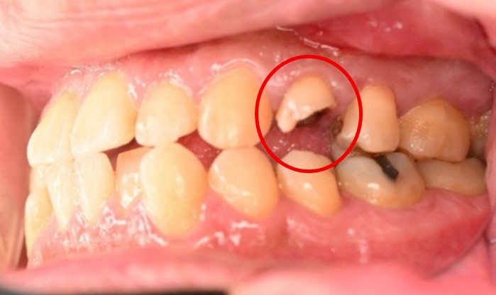 �����륻��ߥå���