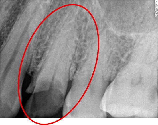 �����륻��ߥå���