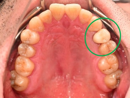 �����륻��ߥå���