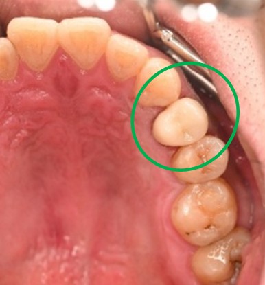 �����륻��ߥå���