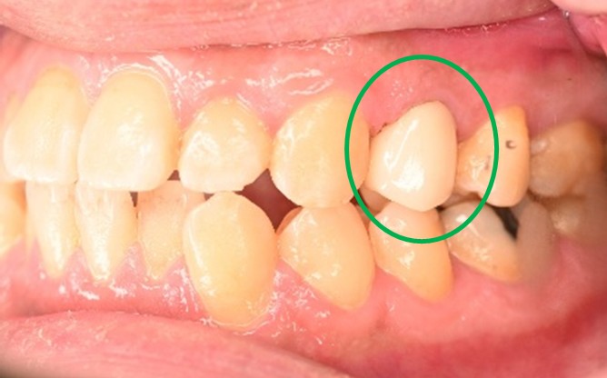 �����륻��ߥå���