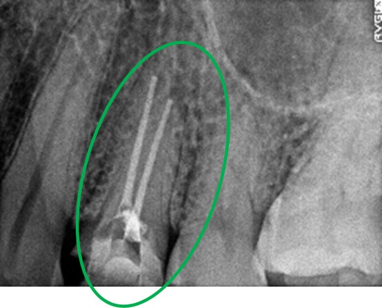 �����륻��ߥå���