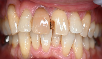 �����륻��ߥå���