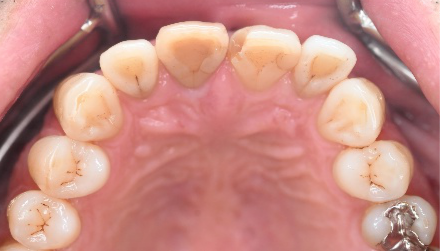 �����륻��ߥå���