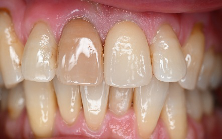 �����륻��ߥå���