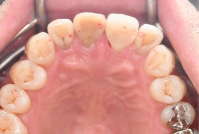 �����륻��ߥå���