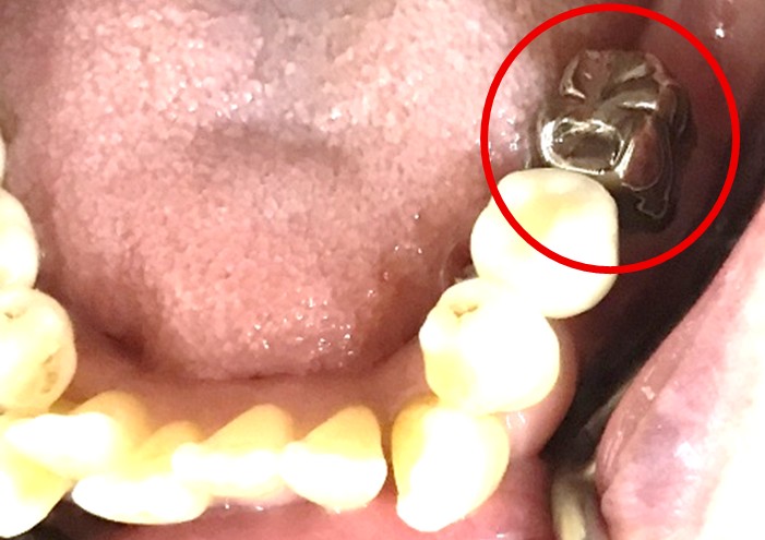 �����륻��ߥå���