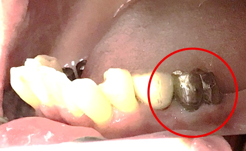 �����륻��ߥå���