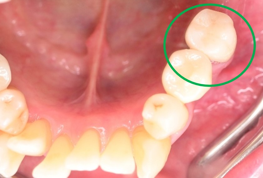 �����륻��ߥå���