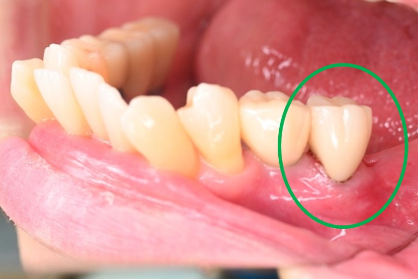 �����륻��ߥå���