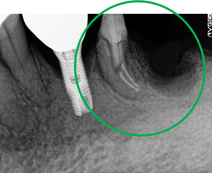 �����륻��ߥå���