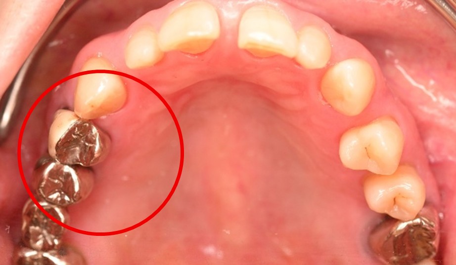 �����륻��ߥå���