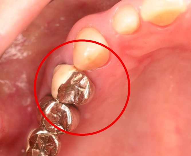 �����륻��ߥå���