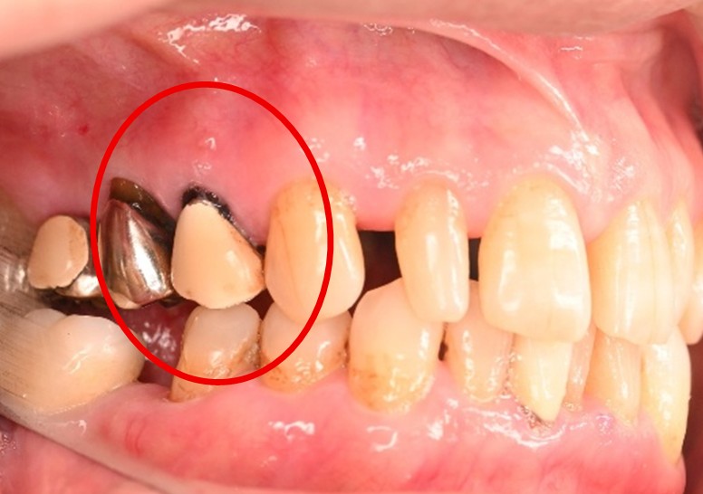 �����륻��ߥå���