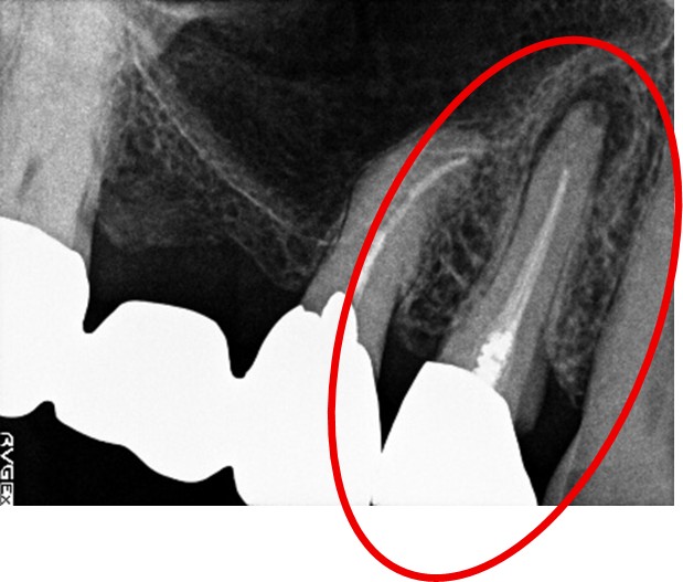 �����륻��ߥå���