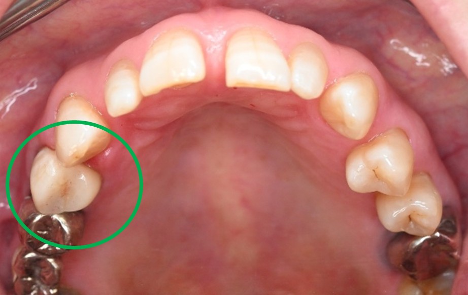 �����륻��ߥå���