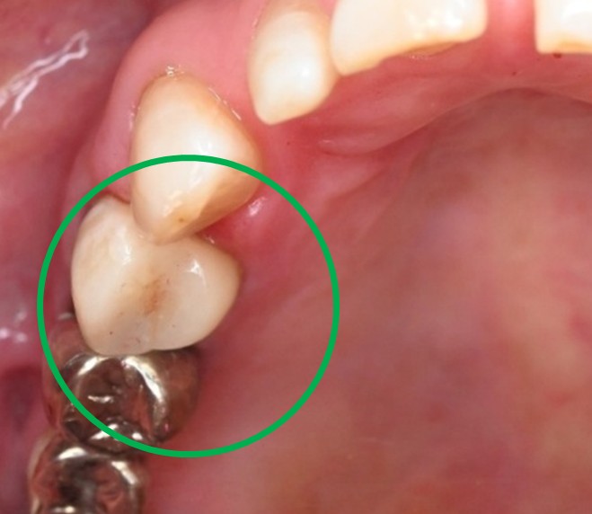 �����륻��ߥå���