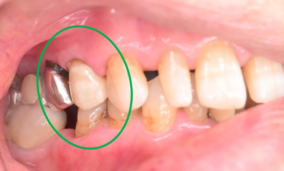 �����륻��ߥå���