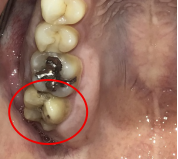 �����륻��ߥå���