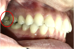 �����륻��ߥå���