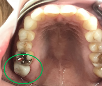 �����륻��ߥå���