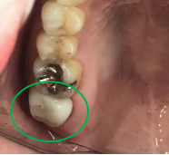 �����륻��ߥå���