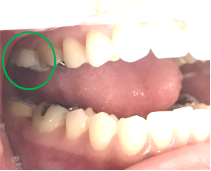 �����륻��ߥå���