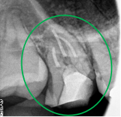 �����륻��ߥå���