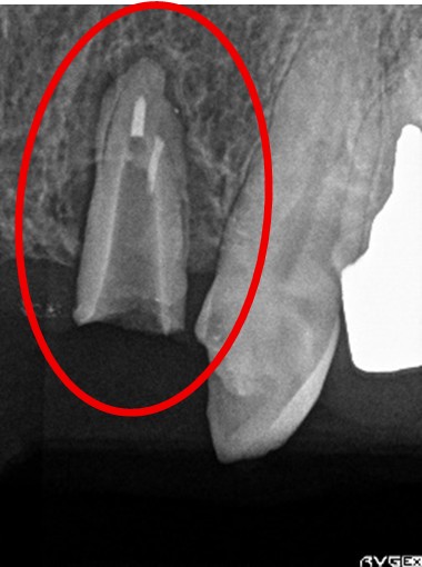 スマートデンチャー