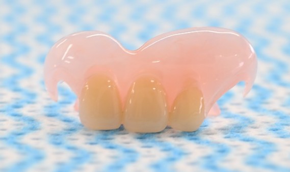 スマートデンチャー