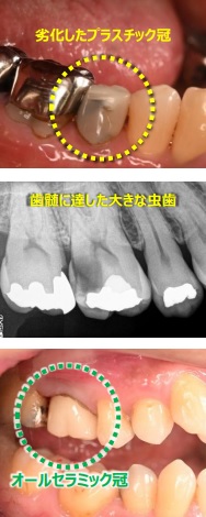 治療前後