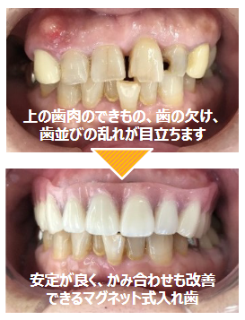 治療前後