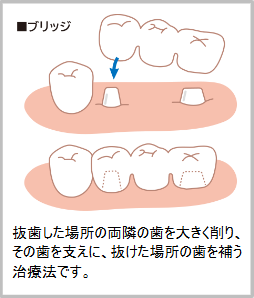 治療前後