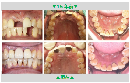 治療後