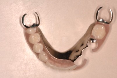 スマートデンチャー