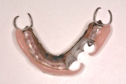 スマートデンチャー