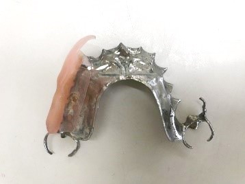 スマートデンチャー