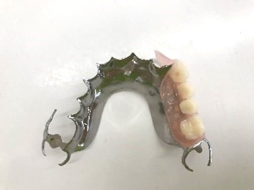 スマートデンチャー